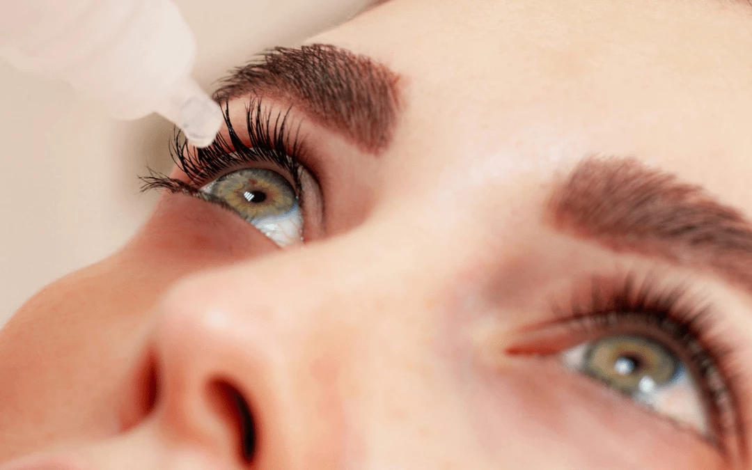 A Woman Eyes Up Close While Putting Eye Drop Into One Eye