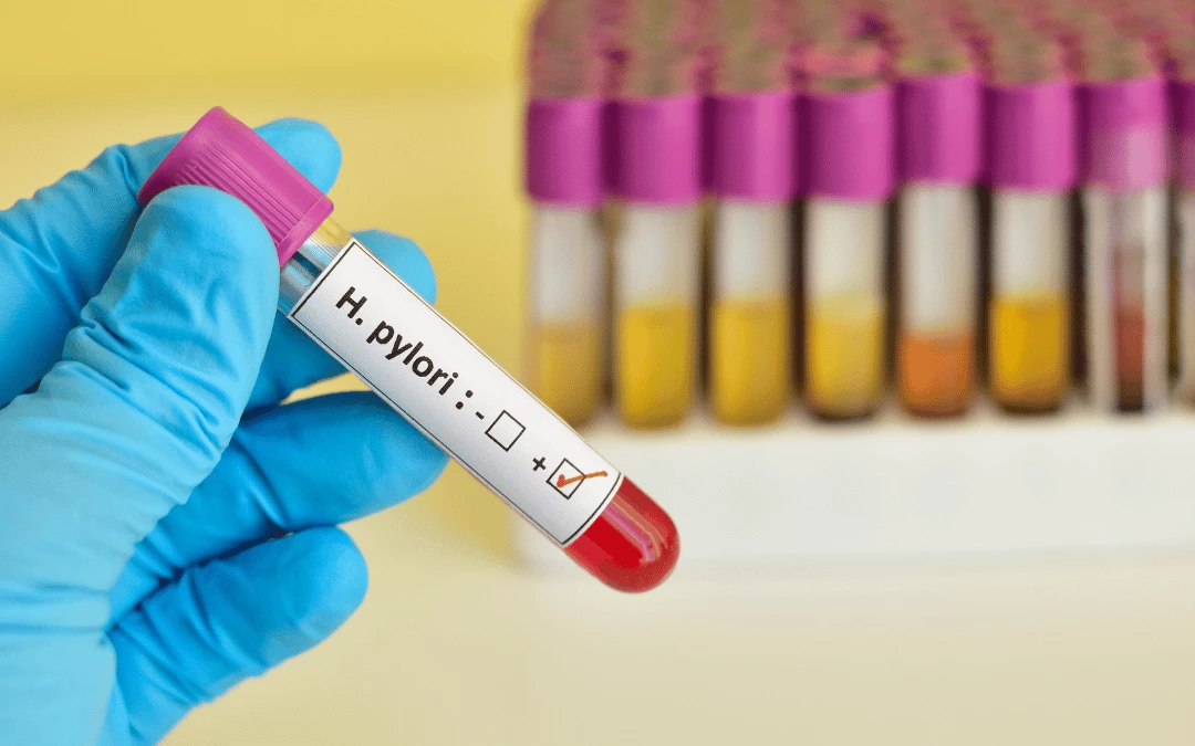 A Close Up Hand In Glove Holding A Test Tube With Blood And Positive Helicobacter Pylori Infection